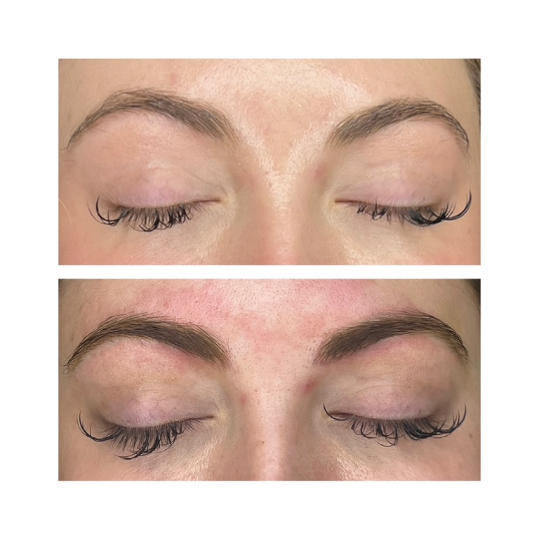 Before / Immediately After Powder
Brow Treatment